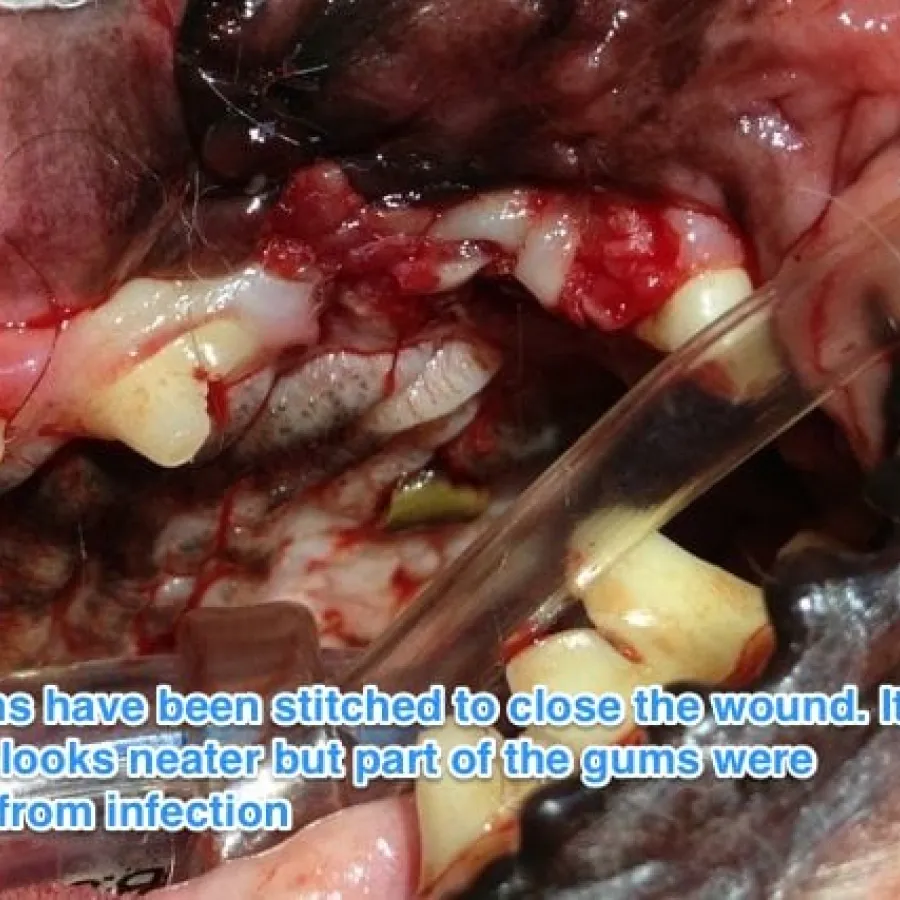 closed goingival flap