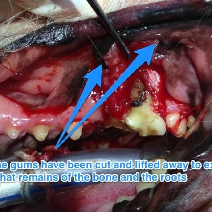 creating a gingival flap