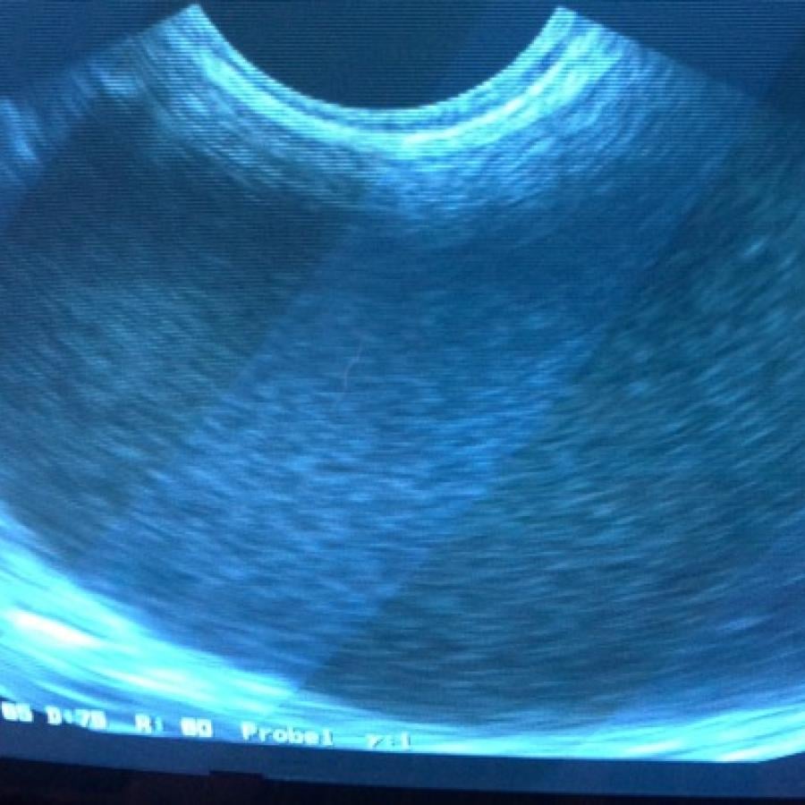 ultrasound with a large fluid filled structure