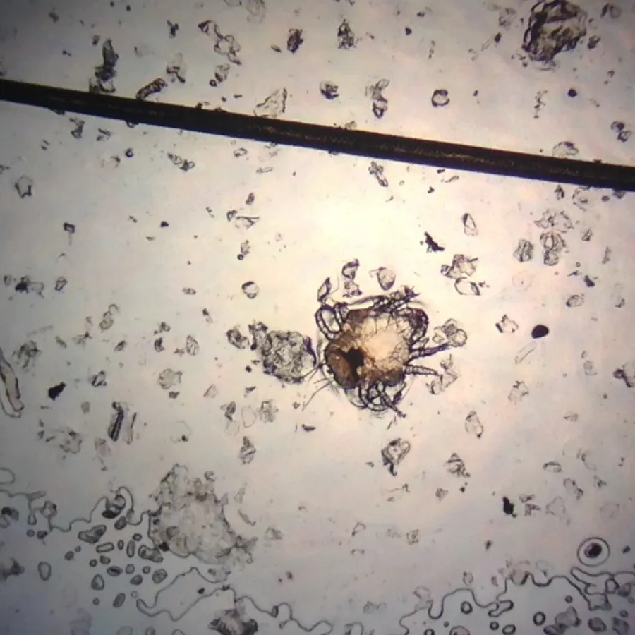 A rabbit fur mite as seen under the microscope